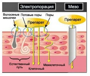 electroporaciya